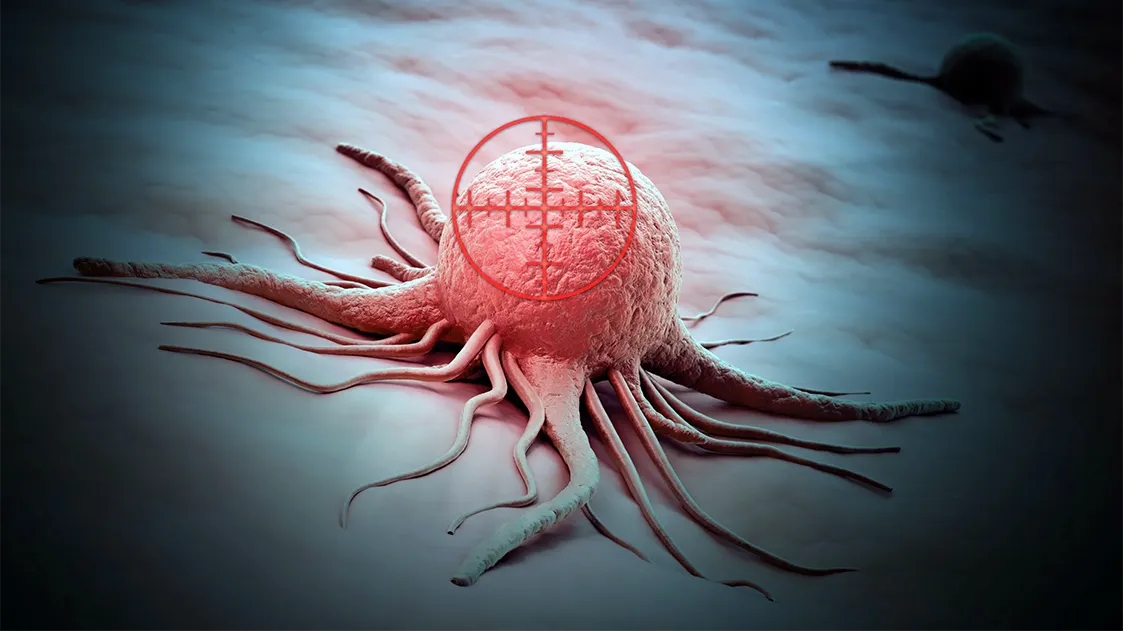 Какие виды рака в Беларуси обнаруживают слишком поздно