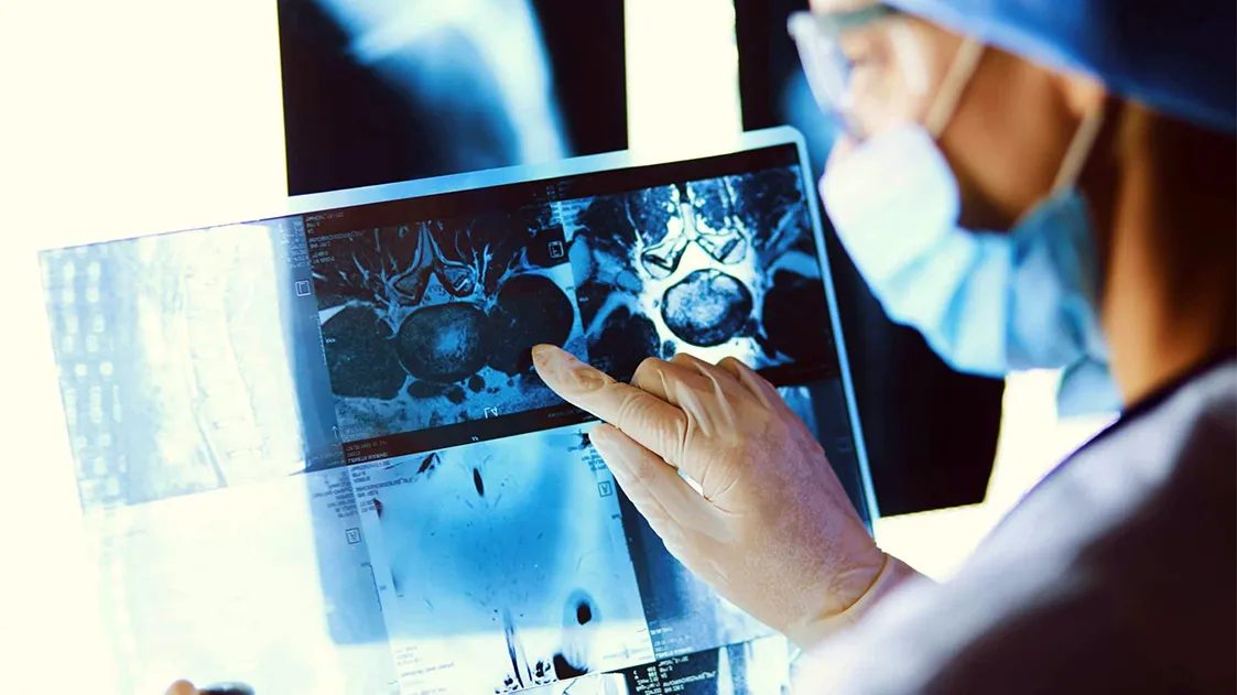 В Беларуси внедряют скрининг для раннего выявления рака легких